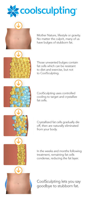 CoolSculpting® in Houston, TX