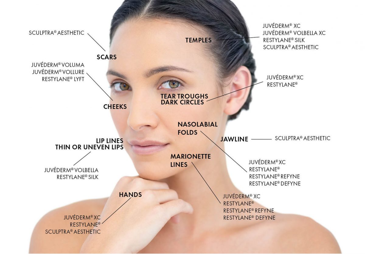 juvÉderm dermal fillers in