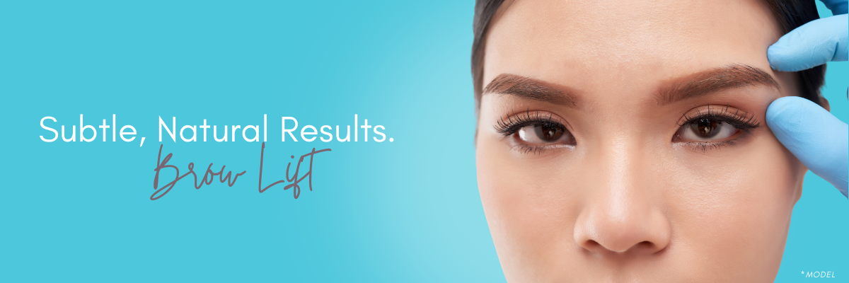 f3b0ef44b7ffe616d3076ef029eae17f Brow Lift