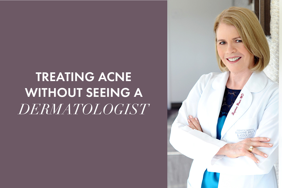Treating Acne Without Seeing a Dermatologist