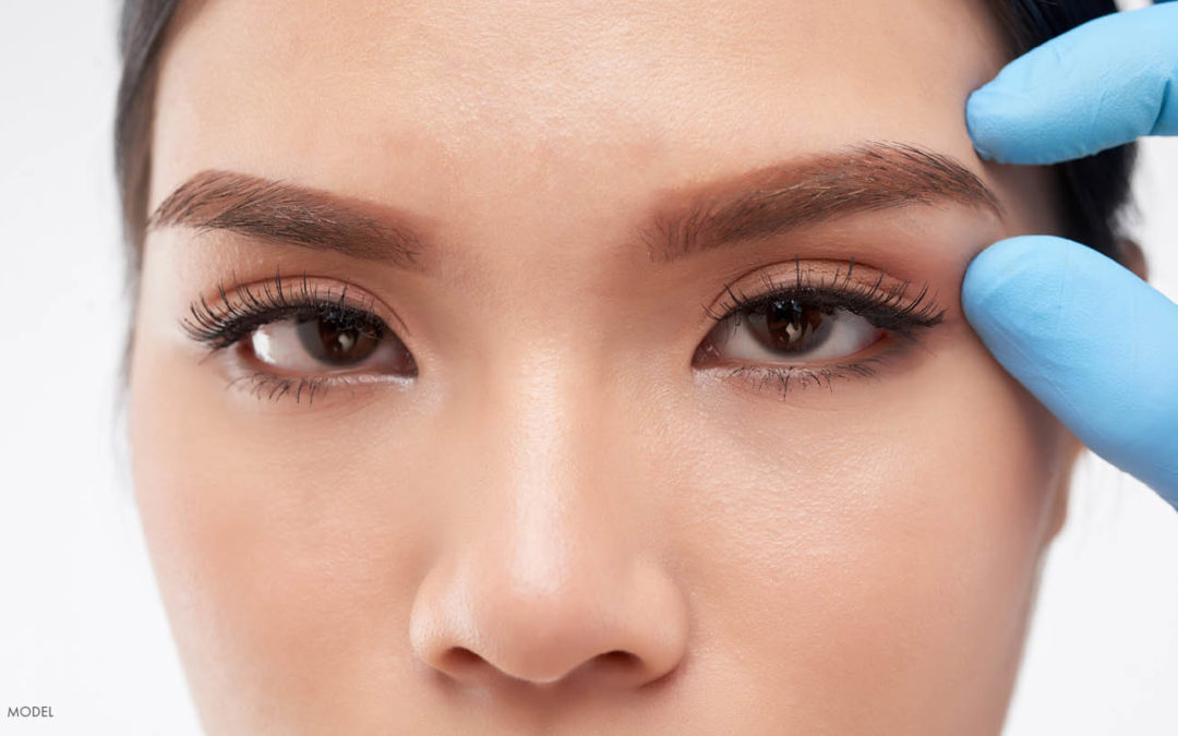 Six Reasons To Consider A Brow Lift