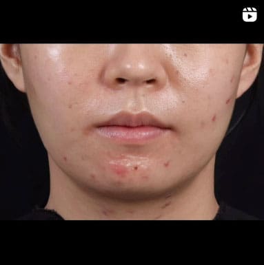 SBA Dermatology Instagram
